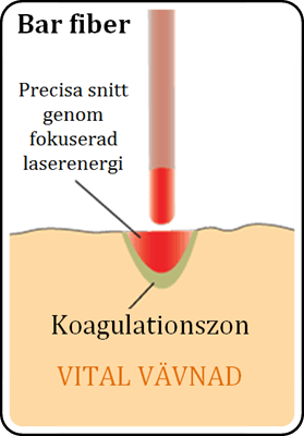 Bar_fiber_schematisk_bild.png