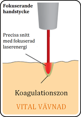 Fokuserande_handstyck_schematisk_bild.png