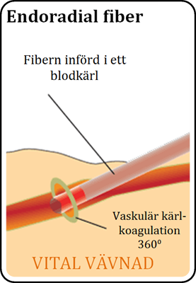 endoradial_fiber_schematisk_bild.png